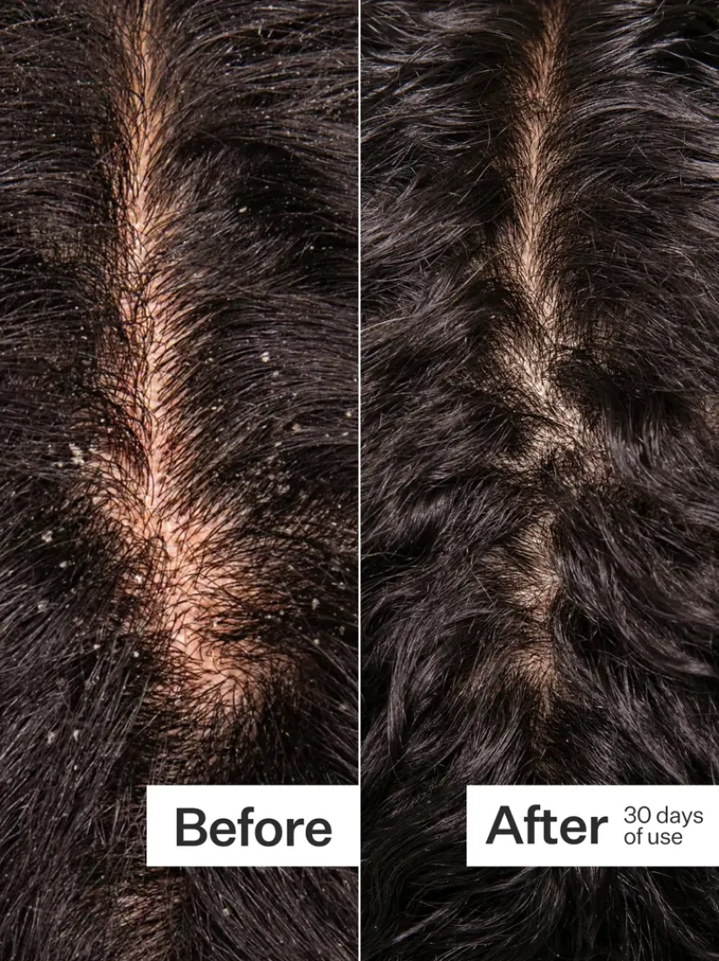 actacre_microbiome_coolin_4.webp Act+Acre Microbiome Cooling Scalp Serum | MECCA Hot