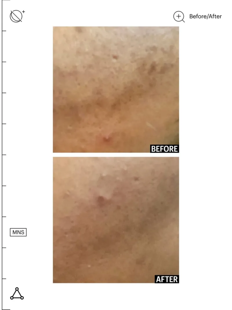 allies_of_skin_mandelic_p_6.webp Allies of Skin Mandelic Pigmentation Corrector Night Serum | MECCA Online