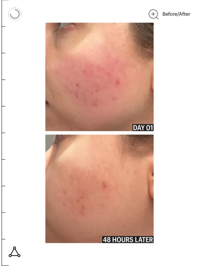 allies_of_skin_molecular__6.webp Allies of Skin Molecular Barrier Recovery Cream Balm | MECCA Hot