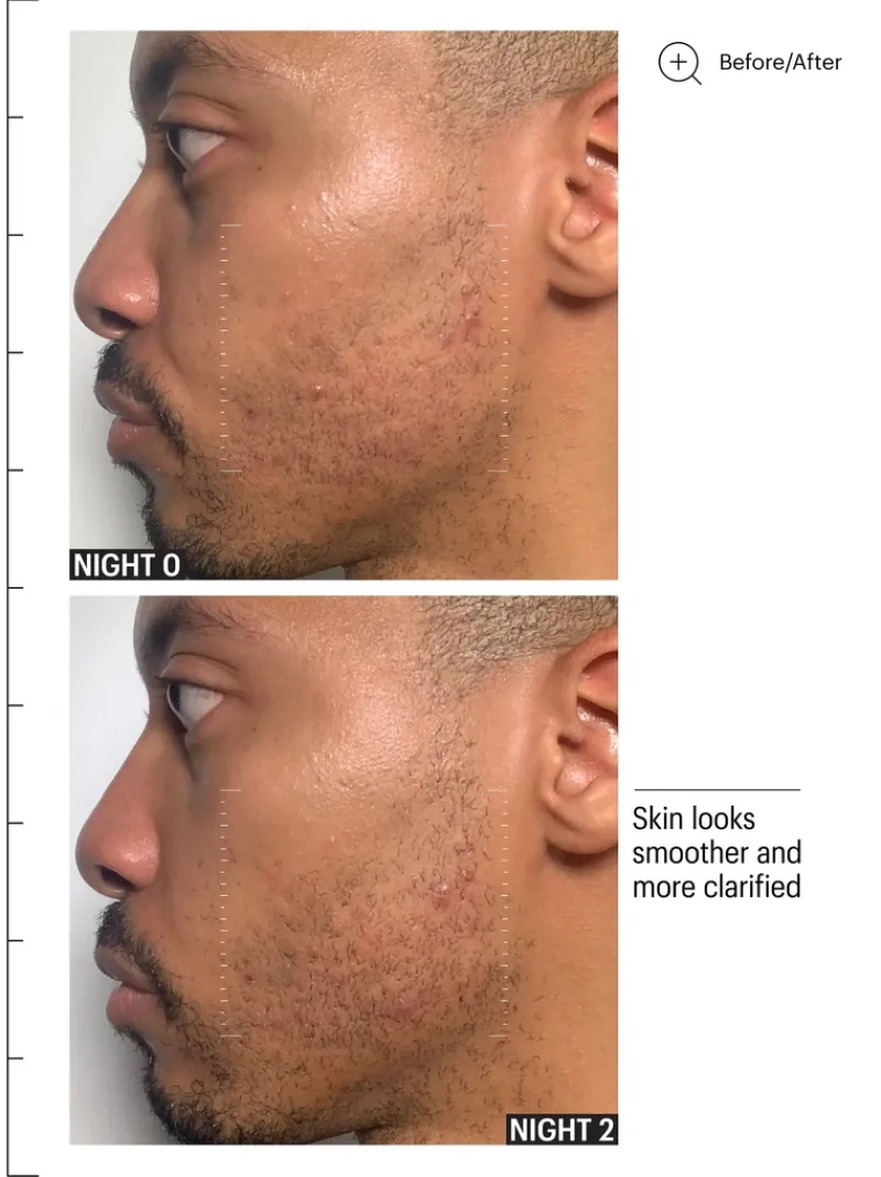 allies_of_skin_multi_acid_6.webp Allies of Skin Multi Acids & Retiniod Brightening Sleeping Facial | MECCA New
