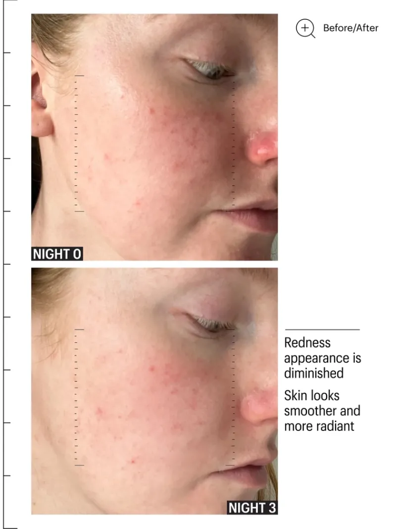 allies_of_skin_multi_acid_7.webp Allies of Skin Multi Acids & Retiniod Brightening Sleeping Facial | MECCA New