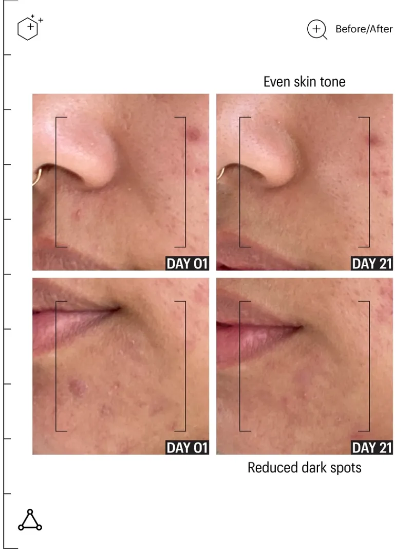 allies_of_skin_tranexamic_6.webp Allies of Skin Tranexamic & Arbutin Brightening Serum | MECCA Hot