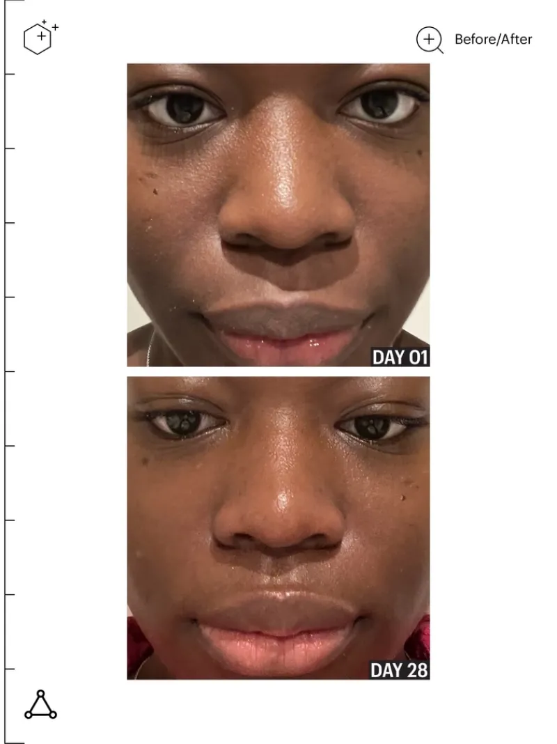 allies_of_skin_tranexamic_7.webp Allies of Skin Tranexamic & Arbutin Brightening Serum | MECCA Hot
