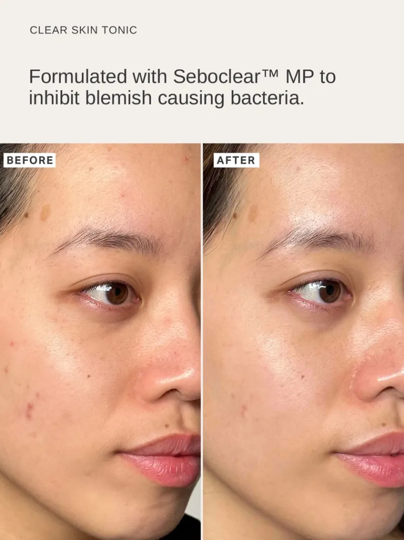 alphah_clear_skin_daily_h_2.webp Alpha-H Clear Skin Daily Hydrator Gel with 2.5% Niacinamide | MECCA Clearance