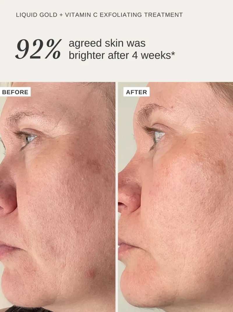 Alpha-H Liquid Gold with Vitamin C | MECCA Hot