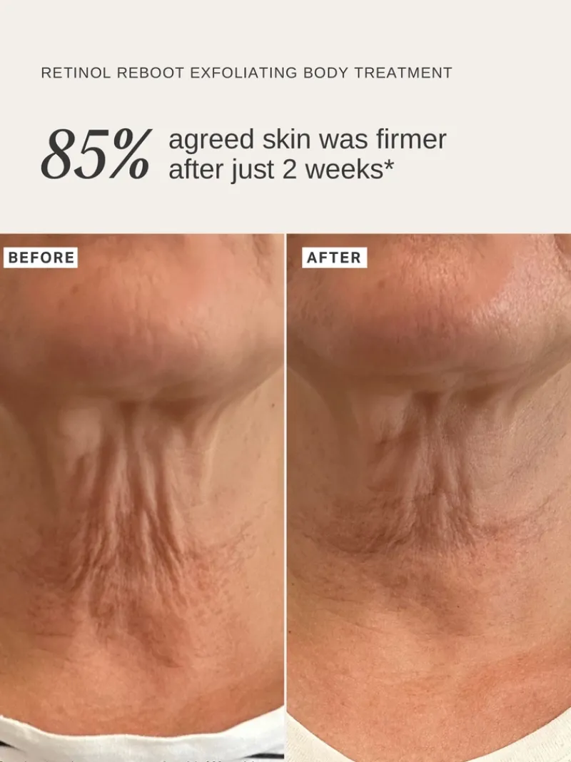 alphah_retinol_exfoliatin_7.webp Alpha-H Retinol Exfoliating Body Treatment | MECCA Sale