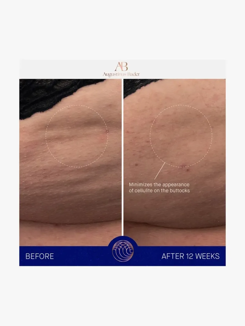 augustinus_bader_the_body_2.webp Augustinus Bader The Body Cream | MECCA Best