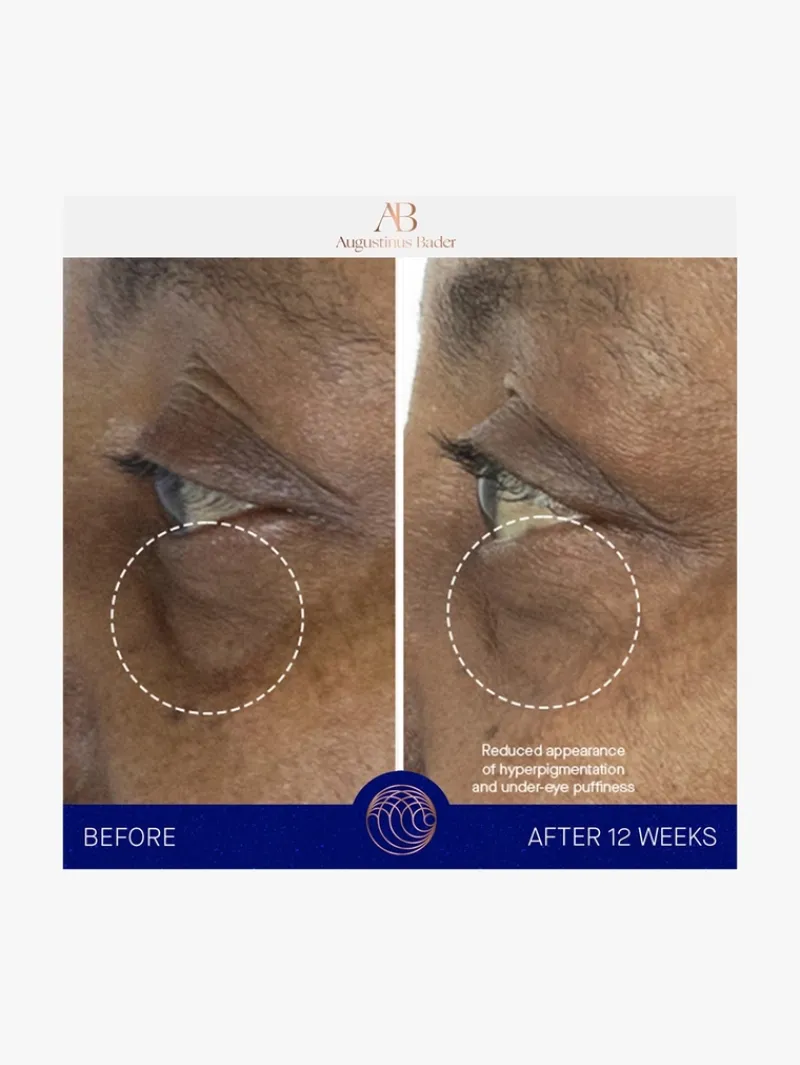 augustinus_bader_the_eye__10-1.webp Augustinus Bader The Eye Cream | MECCA Fashion