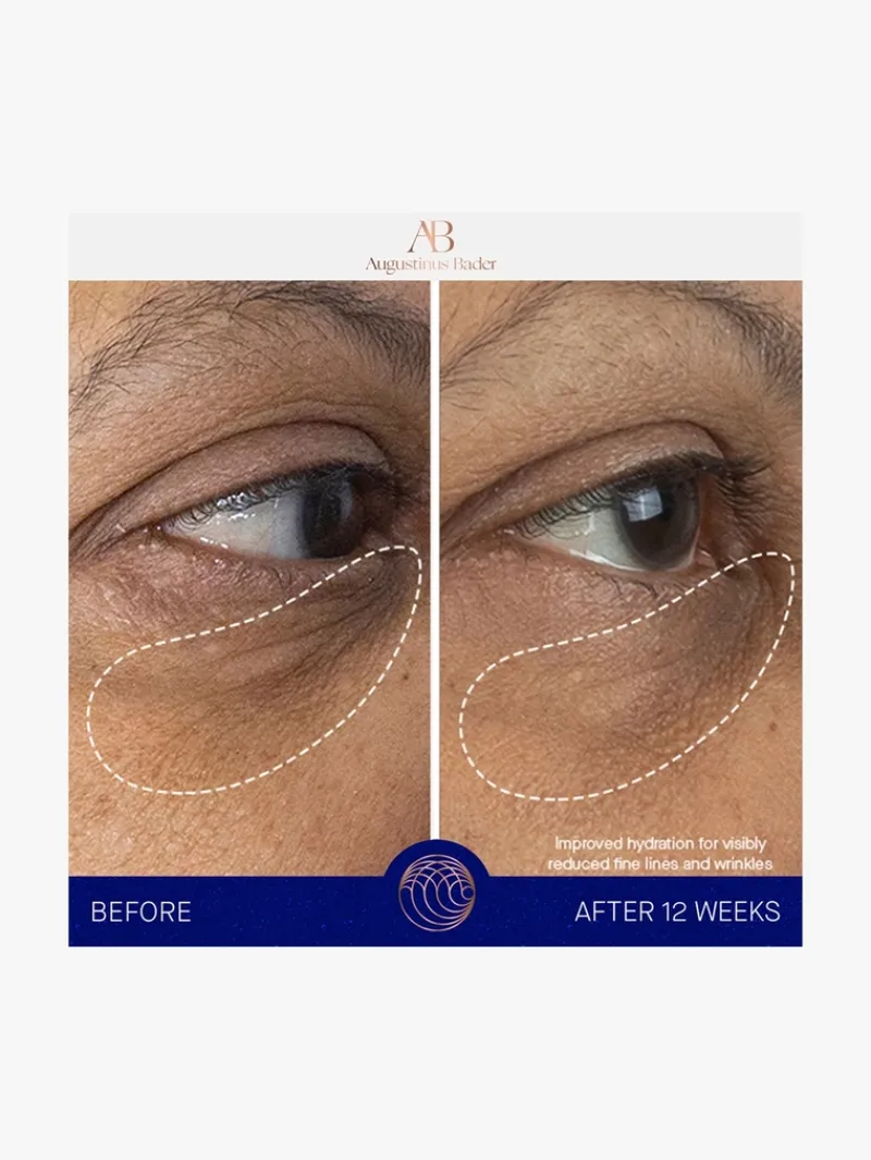 augustinus_bader_the_eye__9-1.webp Augustinus Bader The Eye Cream | MECCA Fashion