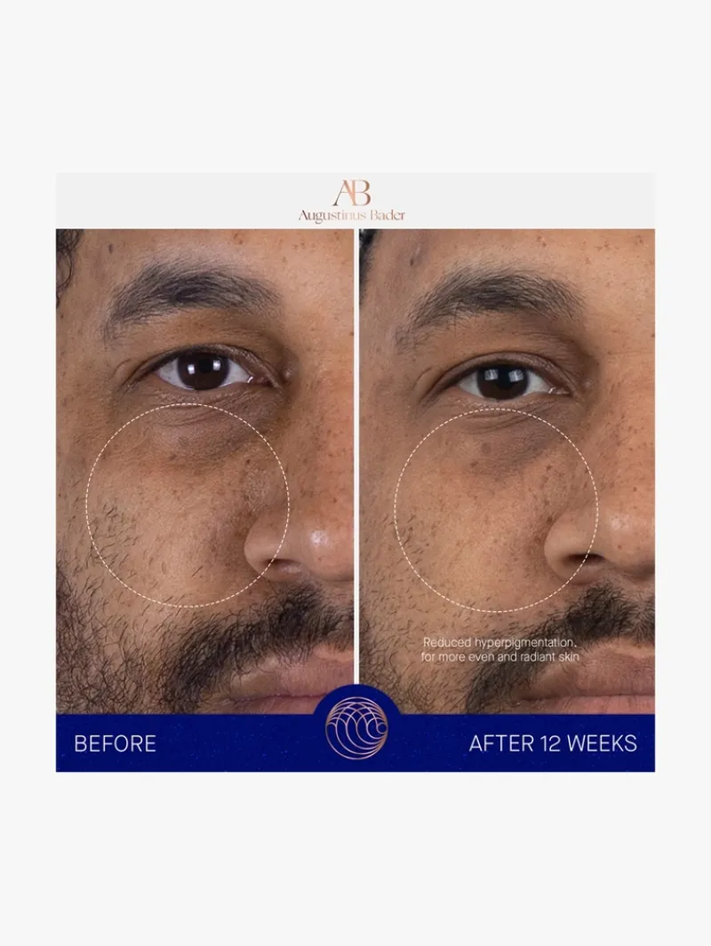 augustinus_bader_the_seru_7.webp Augustinus Bader The Serum | MECCA New