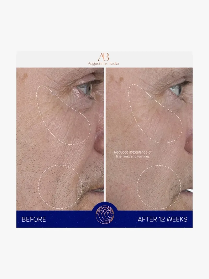augustinus_bader_the_seru_8.webp Augustinus Bader The Serum | MECCA New