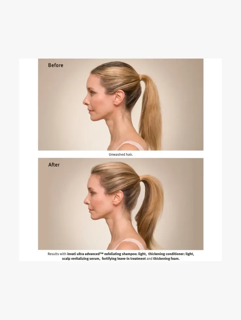 AVEDA Invati Ultra Advanced™ Light System Set | MECCA Discount