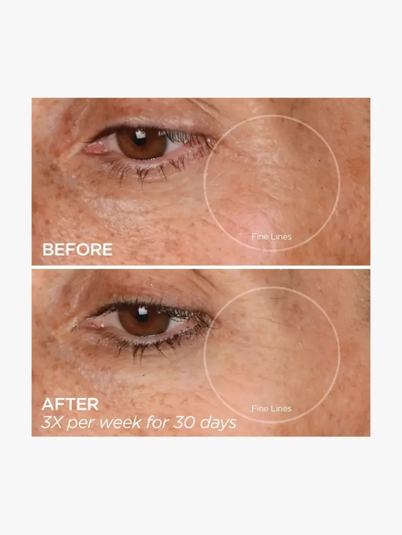beautybio_glopro_eye_micr_5.webp BeautyBio Glopro® Eye Microtip™ | MECCA Online