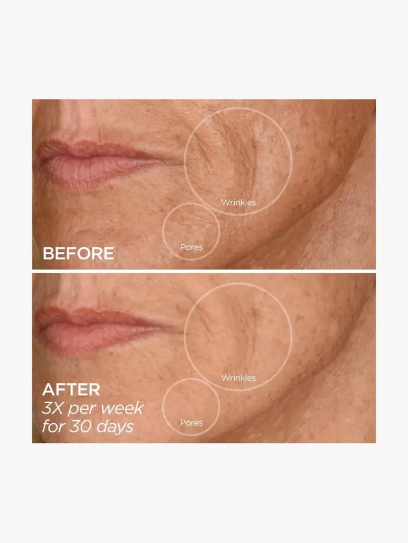 beautybio_glopro_face_mic_4.webp BeautyBio GloPro® Face Microtip™ | MECCA Discount