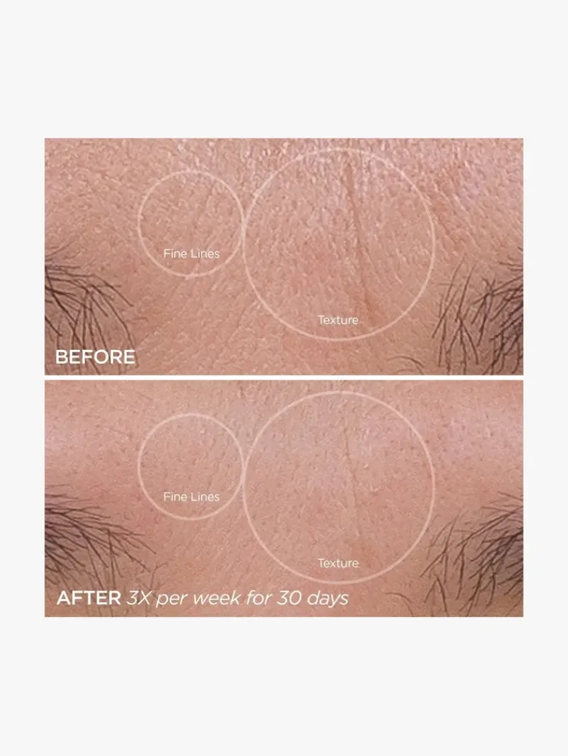 beautybio_glopro_face_mic_5.webp BeautyBio GloPro® Face Microtip™ | MECCA Discount