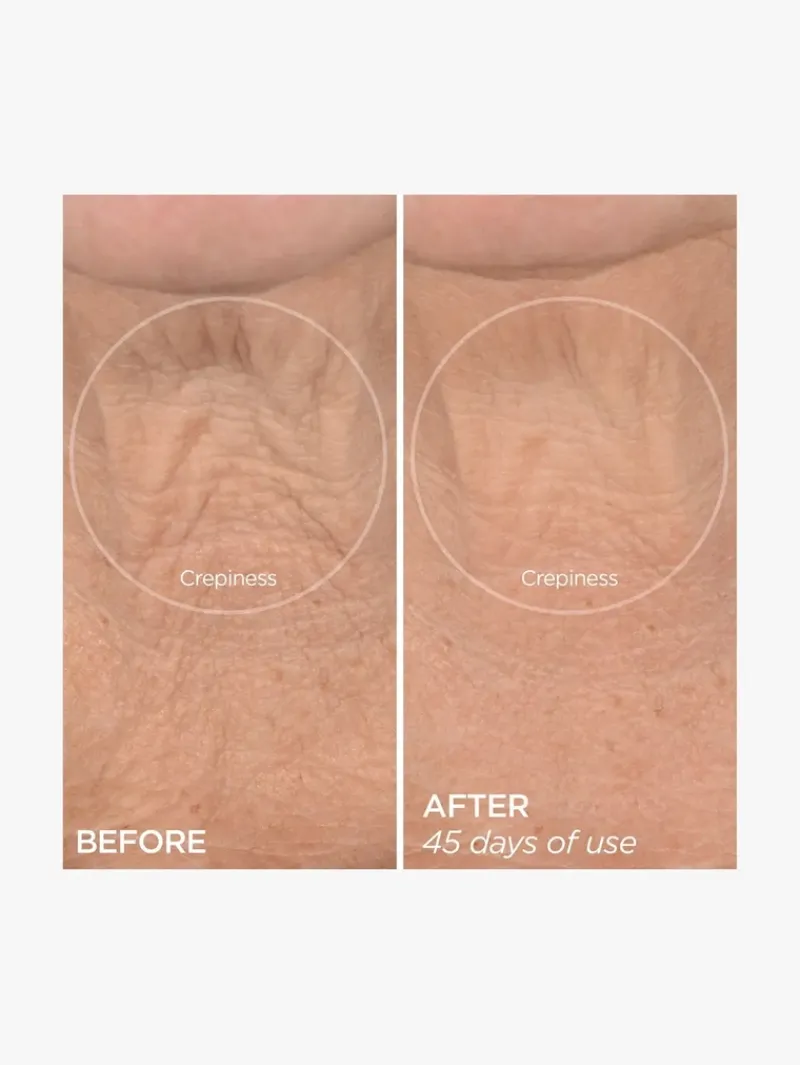 beautybio_r_the_lift_adva_7.webp BeautyBio R45 The Lift Advanced Neck Contouring Treatment | MECCA Discount