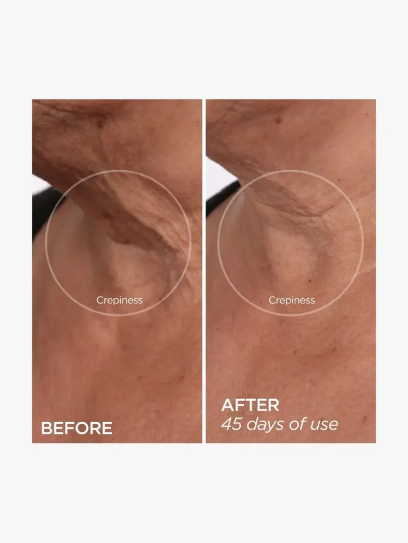 beautybio_r_the_lift_adva_9.webp BeautyBio R45 The Lift Advanced Neck Contouring Treatment | MECCA Discount