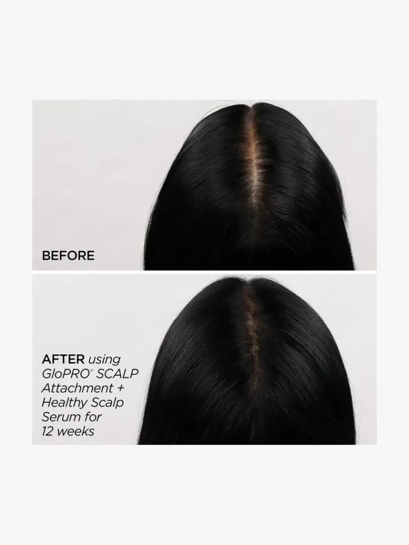 beautybio_rejuvenating_sc_2.webp BeautyBio Rejuvenating Scalp + Fuller Hair Therapy Set | MECCA New