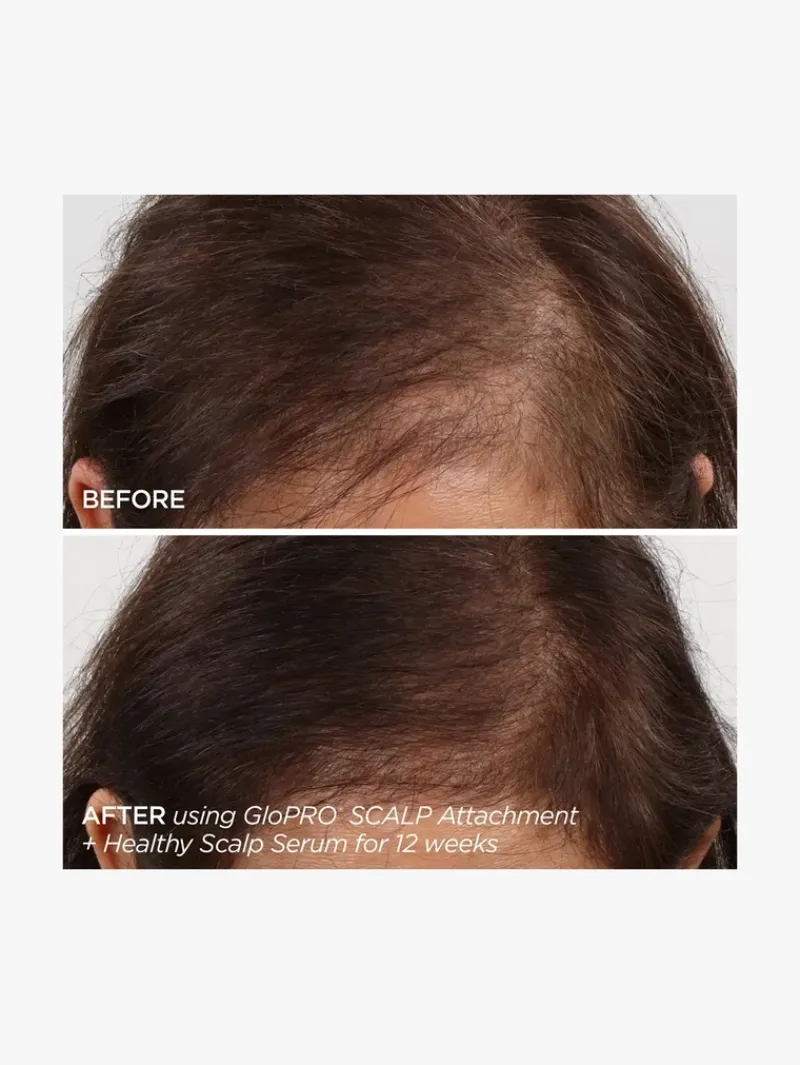 beautybio_rejuvenating_sc_3.webp BeautyBio Rejuvenating Scalp + Fuller Hair Therapy Set | MECCA New