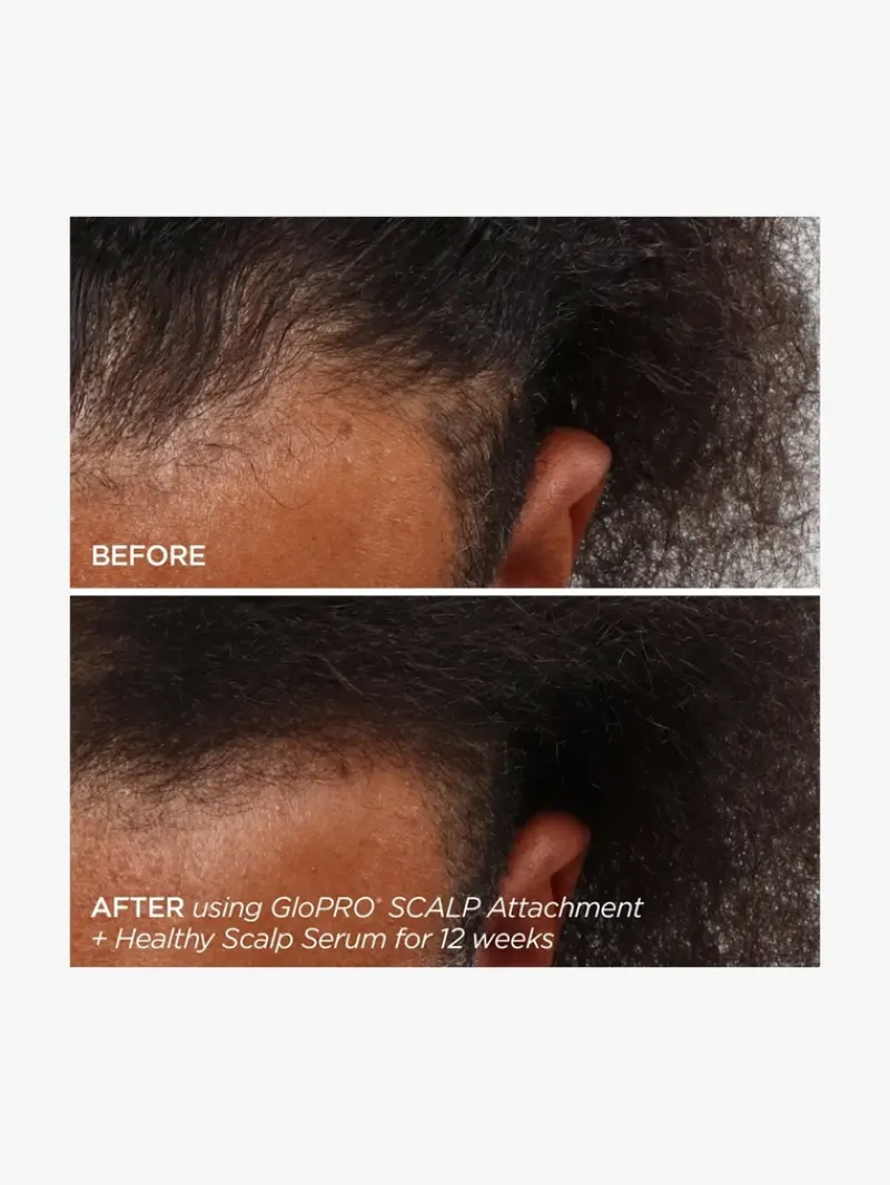 beautybio_rejuvenating_sc_4.webp BeautyBio Rejuvenating Scalp + Fuller Hair Therapy Set | MECCA New