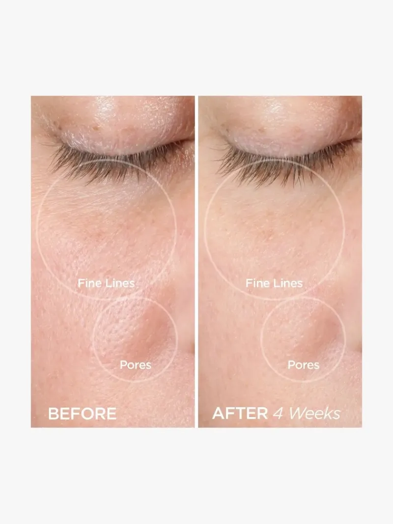 beautybio_the_zenbubble_g_6.webp BeautyBio The ZenBubble Gel Cream Calming Skin Shield | MECCA Outlet