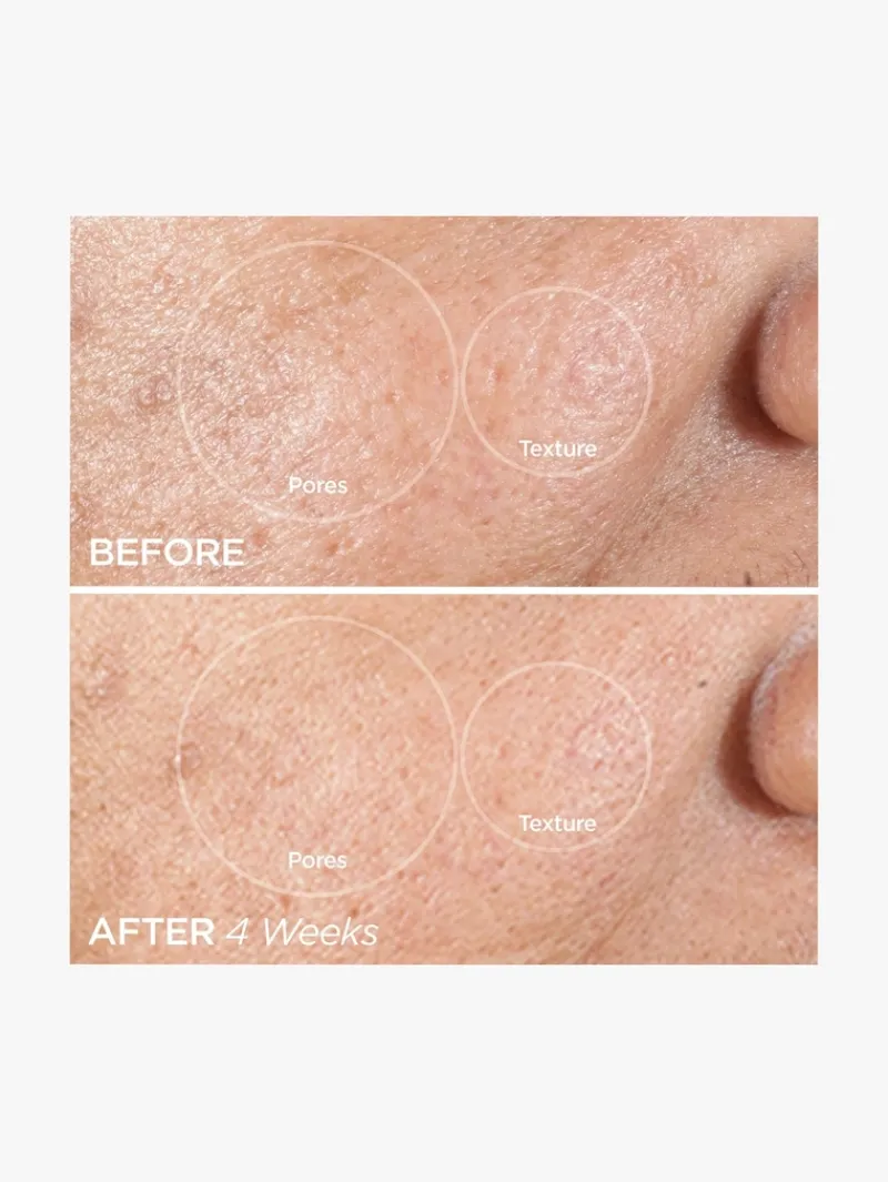 beautybio_the_zenbubble_g_7.webp BeautyBio The ZenBubble Gel Cream Calming Skin Shield | MECCA Outlet