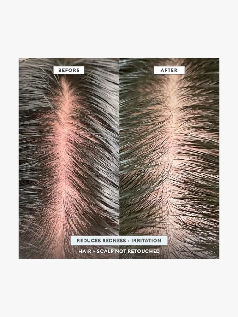 briogeo_scalp_revival_aha_3.webp Briogeo Scalp Revival AHA BHA Shampoo | MECCA New