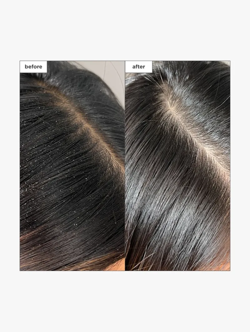 briogeo_scalp_revival_cha_4-3.webp Briogeo Scalp Revival™ Charcoal + Tea Tree Buildup Detox Spray | MECCA Hot