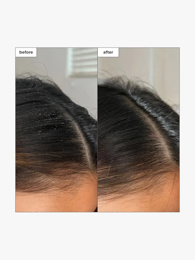 briogeo_scalp_revival_cha_5-3.webp Briogeo Scalp Revival™ Charcoal + Tea Tree Buildup Detox Spray | MECCA Hot