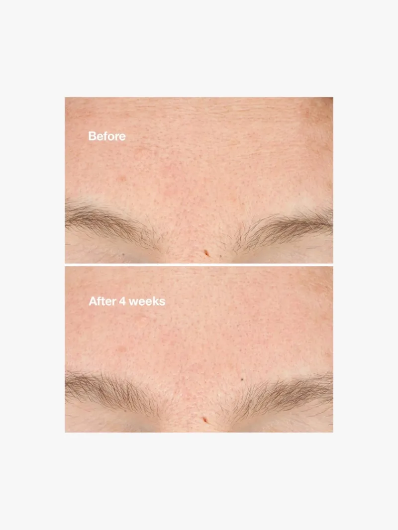 clinique_clarifying_micro_2.webp Clinique Clarifying Micro Peel | MECCA Clearance