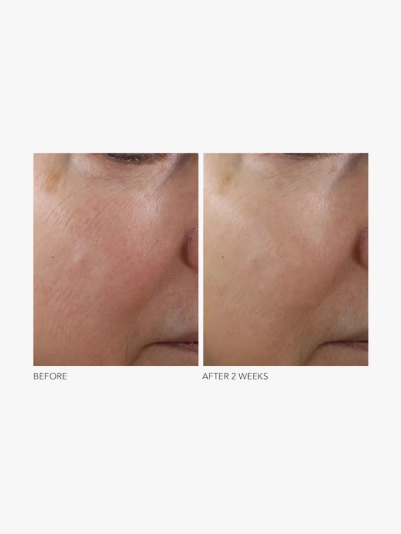 Dr. Dennis Gross Dr Dennis Gross Advanced Retinol + Ferulic Texture Renewal Serum New