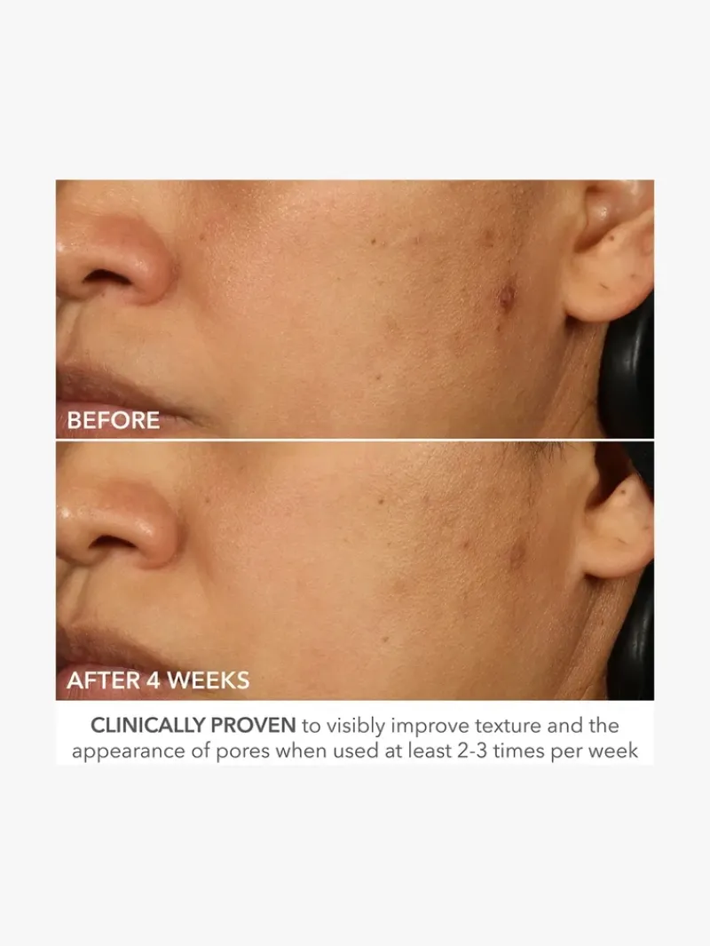 dr_dennis_gross_advanced__10.webp Dr. Dennis Gross Advanced Retinol + Ferulic Perfectly Dosed Retinol Extra Strength 0.5% | MECCA Sale