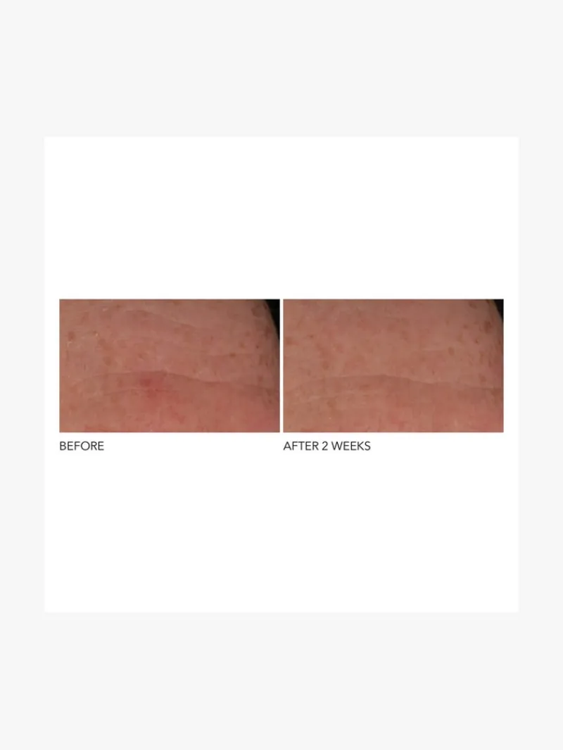 dr_dennis_gross_advanced__2-1.webp Dr. Dennis Gross Dr Dennis Gross Advanced Retinol + Ferulic Overnight Wrinkle Treatment | MECCA Best