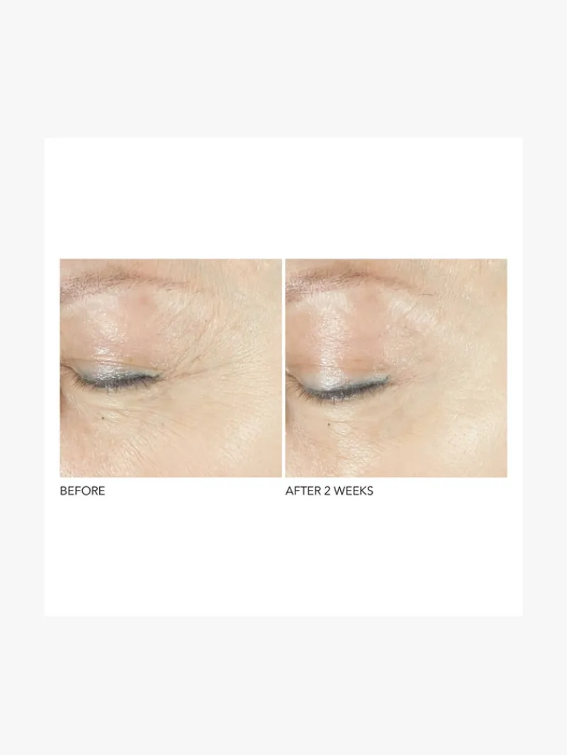 dr_dennis_gross_advanced__2.webp Dr. Dennis Gross Dr Dennis Gross Advanced Retinol + Ferulic Triple Correction Eye Serum | MECCA Discount