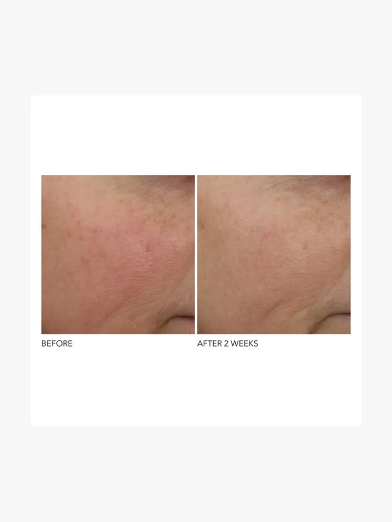 dr_dennis_gross_advanced__3-1.webp Dr. Dennis Gross Dr Dennis Gross Advanced Retinol + Ferulic Overnight Wrinkle Treatment | MECCA Best