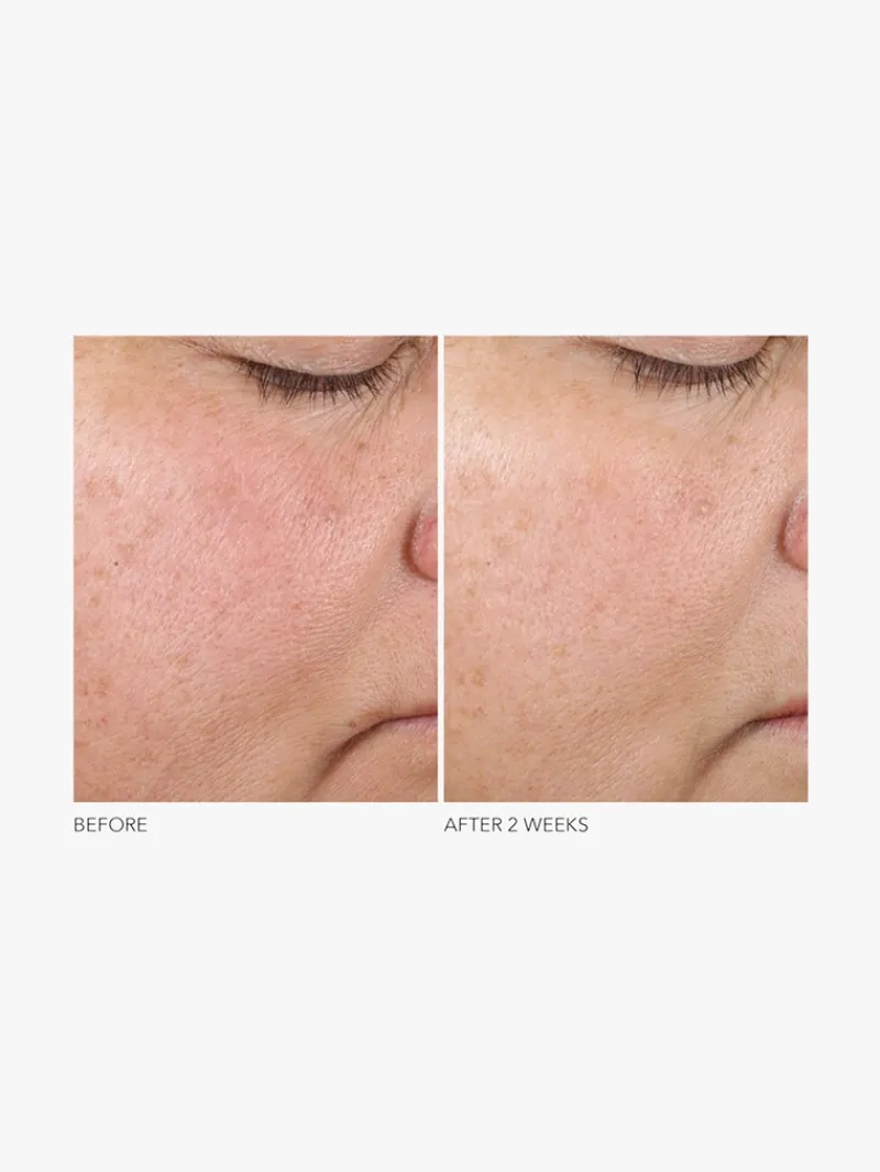dr_dennis_gross_advanced__3-4.webp Dr. Dennis Gross Dr Dennis Gross Advanced Retinol + Ferulic Texture Renewal Serum Best