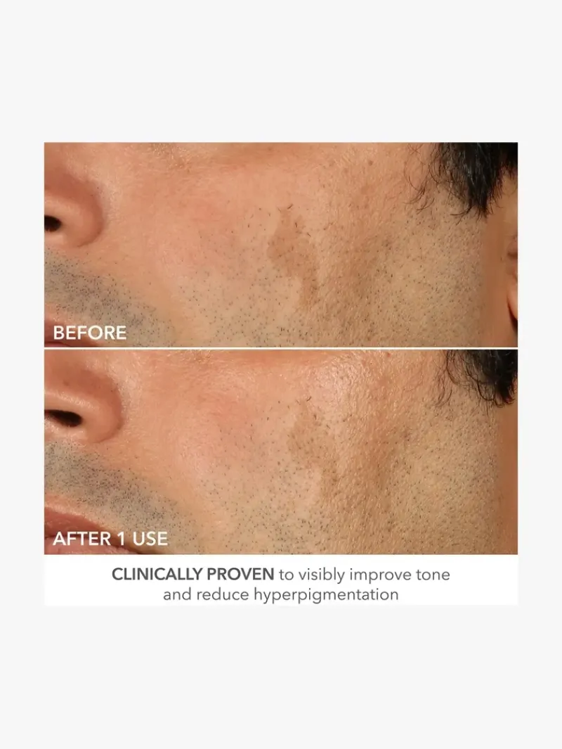 dr_dennis_gross_advanced__9.webp Dr. Dennis Gross Advanced Retinol + Ferulic Perfectly Dosed Retinol Extra Strength 0.5% | MECCA Sale