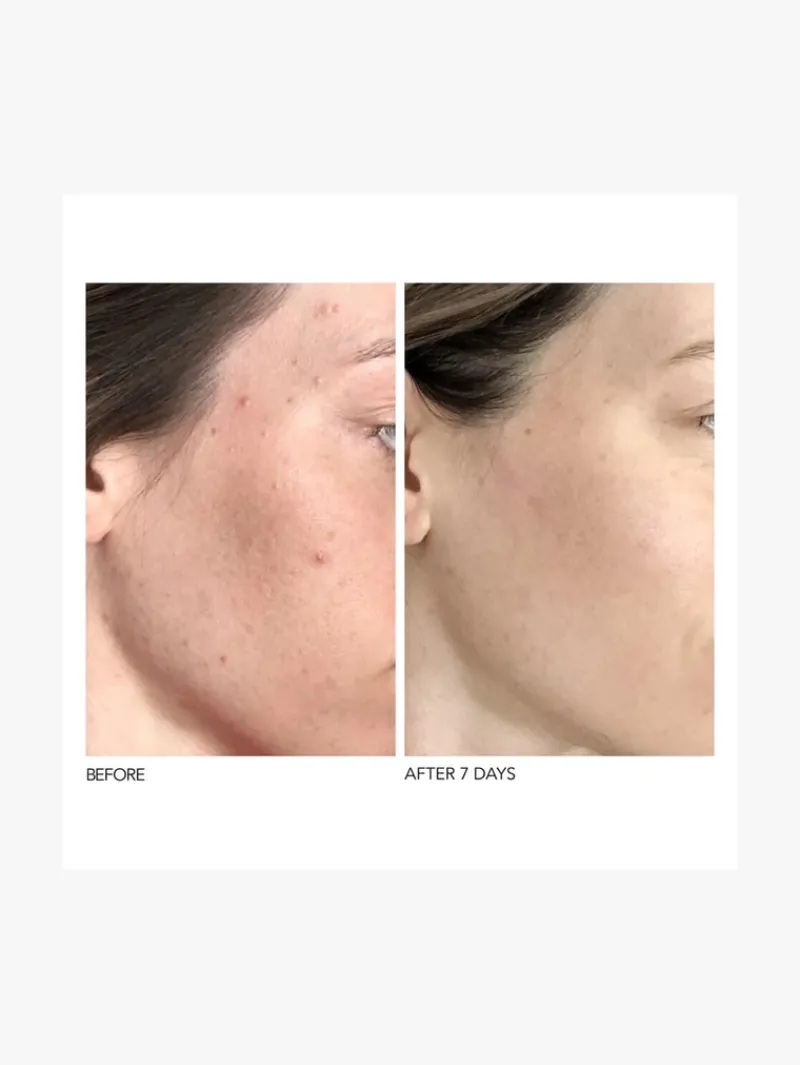 Dr. Dennis Gross Dr Dennis Gross Alpha Beta Universal Daily Peel | MECCA Online