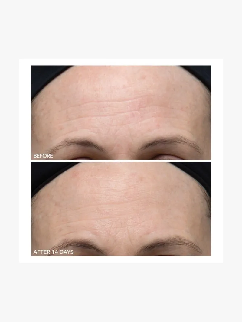 dr_dennis_gross_alpha_bet_2-2.webp Dr. Dennis Gross Dr Dennis Gross Alpha Beta Ultra Gentle Peel | MECCA Fashion