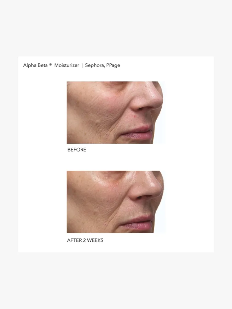 dr_dennis_gross_alpha_bet_4.webp Dr. Dennis Gross Dr Dennis Gross Alpha Beta Daily Moisturizer | MECCA Clearance