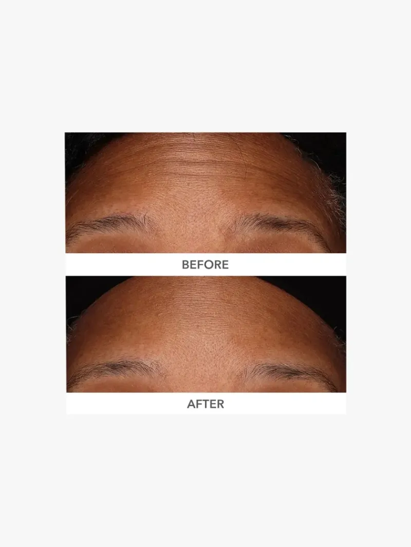 dr_dennis_gross_derminfus_4-2.webp Dr. Dennis Gross DermInfusions 3D Plump, Fill and Repair | MECCA Clearance