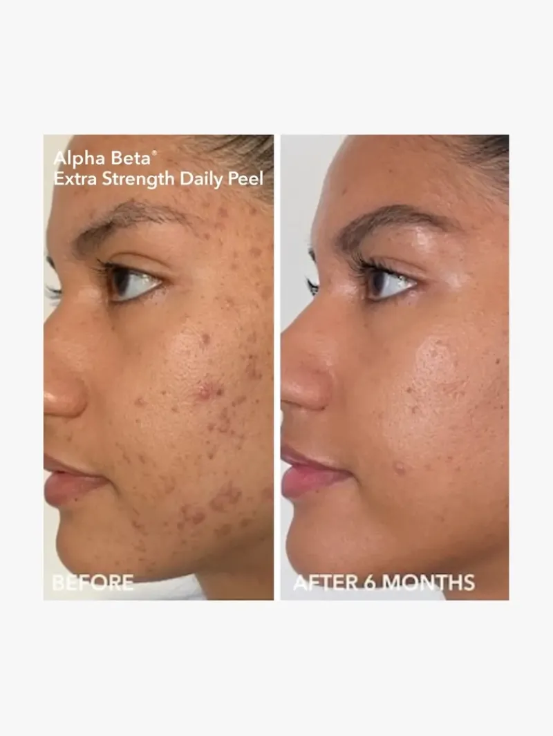 dr_dennis_gross_smooth_ra_3.webp Dr. Dennis Gross Smooth, Radiant, Firm Normal/Oily Skin Kit | MECCA Fashion