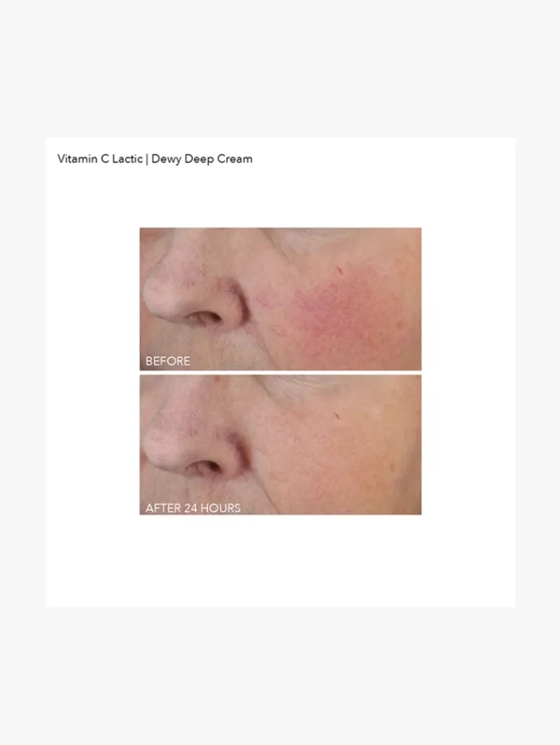 dr_dennis_gross_vitamin_c_5-1.webp Dr. Dennis Gross Dr Dennis Gross Vitamin C + Lactic Dewy Deep Cream | MECCA Fashion