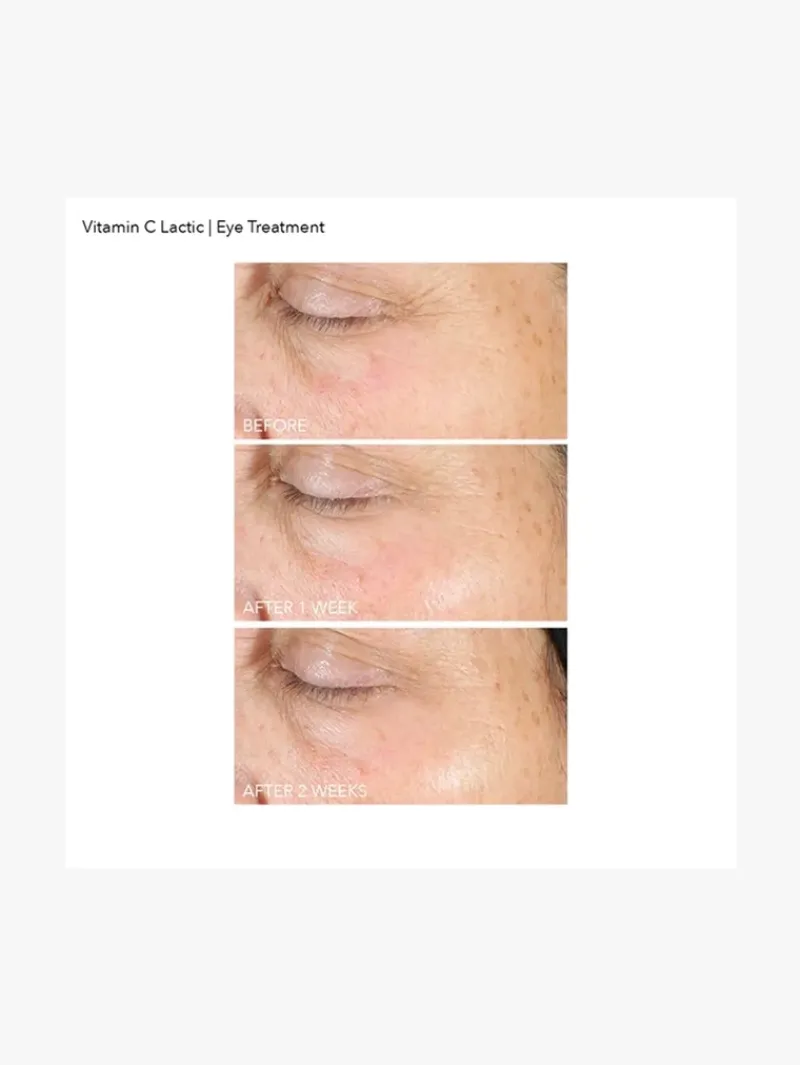 dr_dennis_gross_vitamin_c_5-4.webp Dr. Dennis Gross Dr Dennis Gross Vitamin C+ Lactic Vitamin C Firm & Bright Eye Treatment | MECCA New