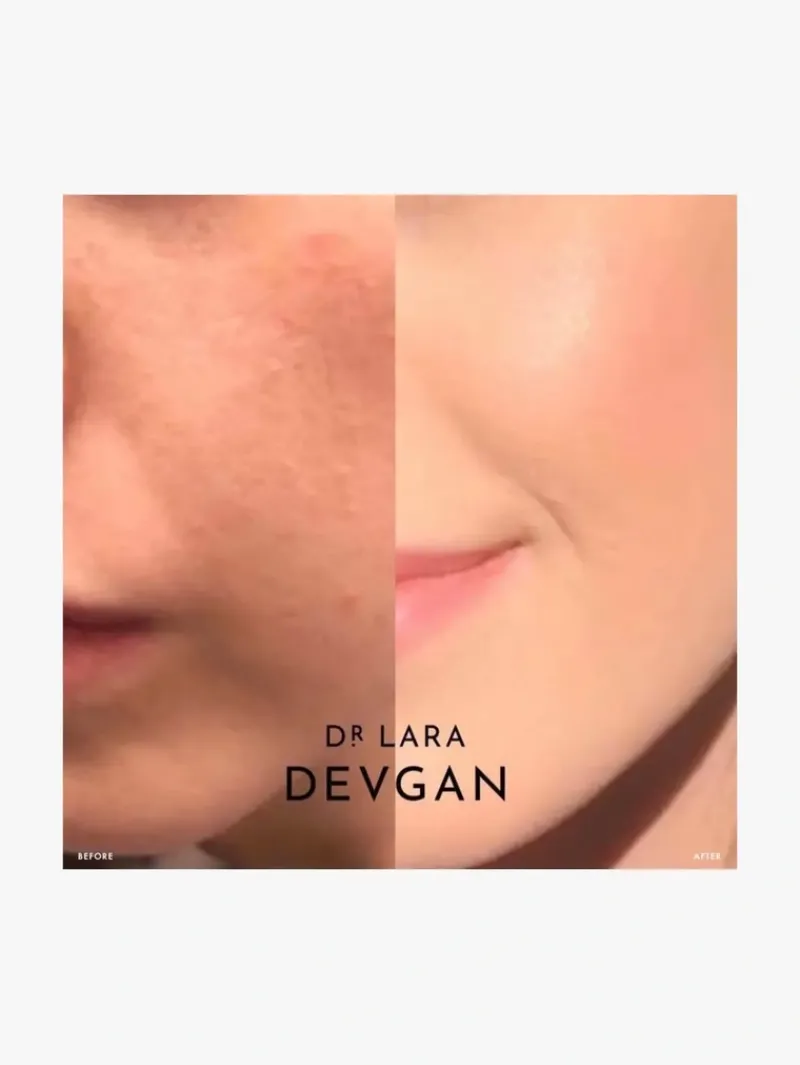 dr_lara_devgan_microderma_4.webp Dr. Lara Devgan Microdermabrasion Scrub | MECCA Clearance