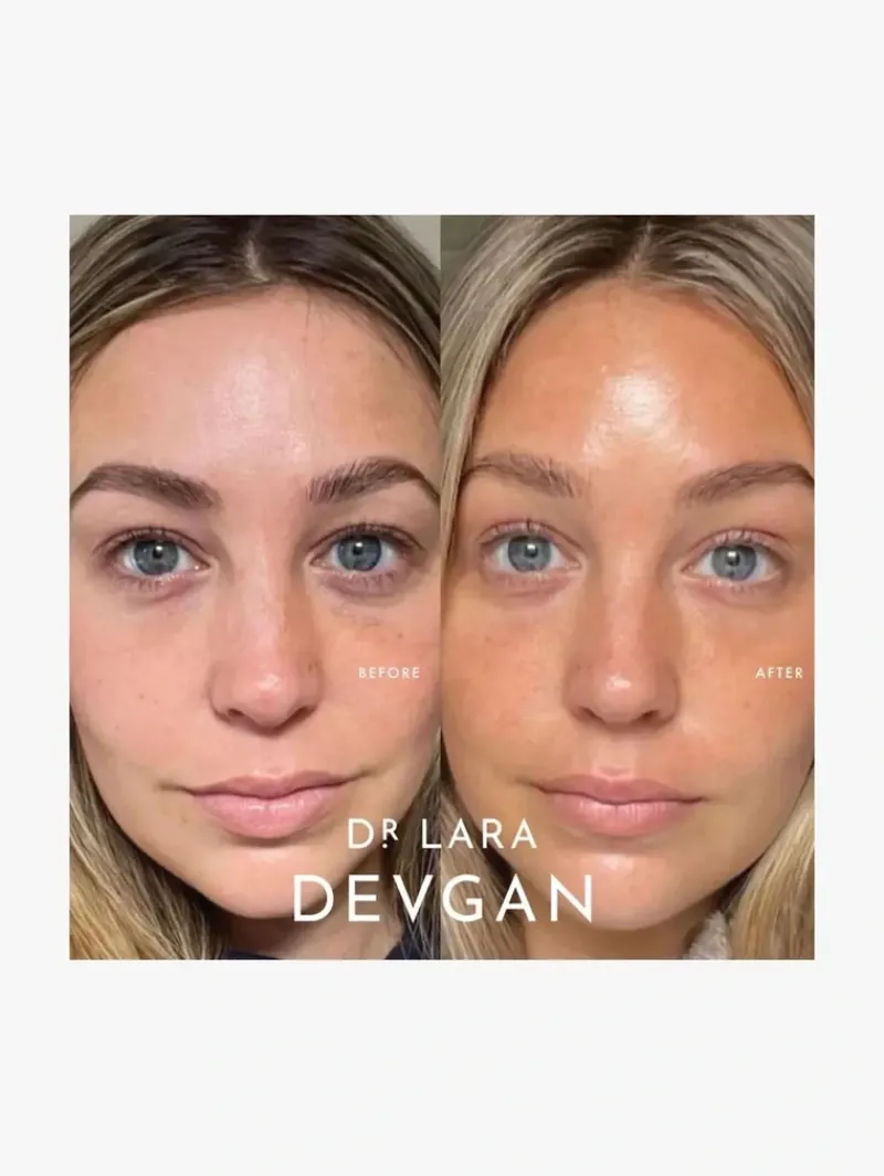 dr_lara_devgan_peptide_ey_5.webp Dr. Lara Devgan Peptide Eye Cream | MECCA Best