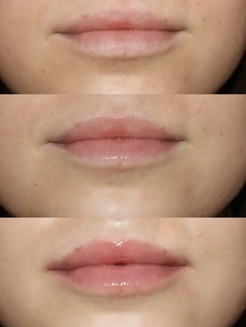 dr_lara_devgan_platinum_l_5.webp Dr. Lara Devgan Platinum Lip Plump | MECCA Best