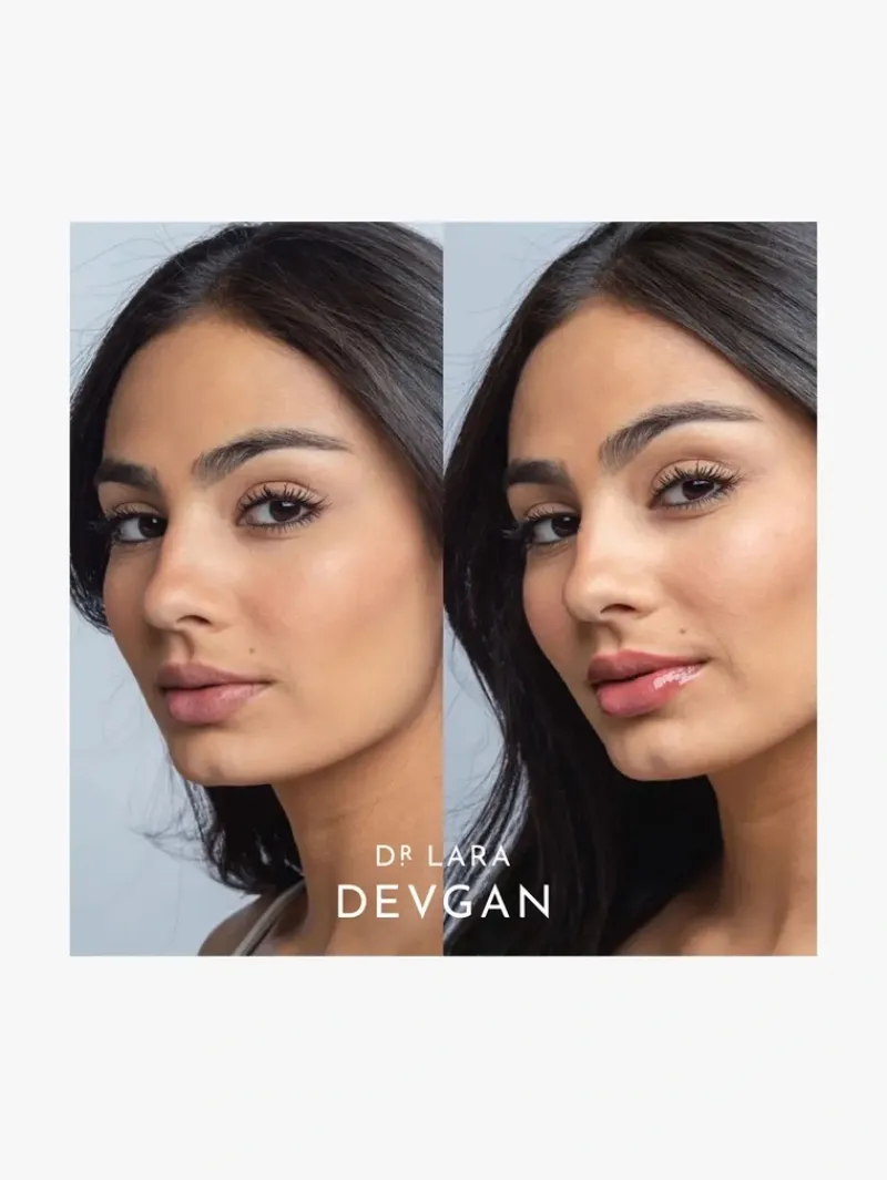 dr_lara_devgan_platinum_l_7.webp Dr. Lara Devgan Platinum Lip Plump | MECCA Best