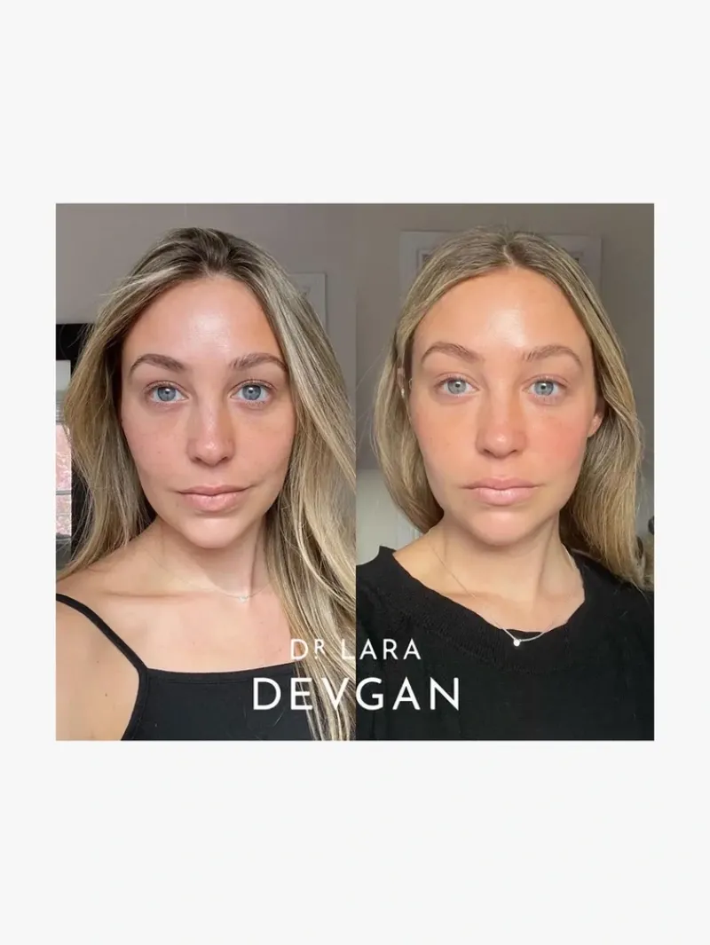 dr_lara_devgan_vitamin_cb_5.webp Dr. Lara Devgan Vitamin CBE Ferulic Serum | MECCA Best