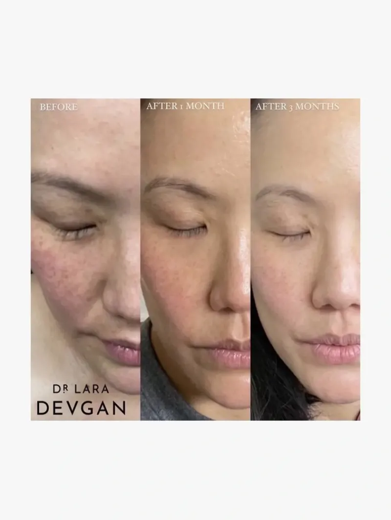 dr_lara_devgan_vitamin_cb_6.webp Dr. Lara Devgan Vitamin CBE Ferulic Serum | MECCA Best